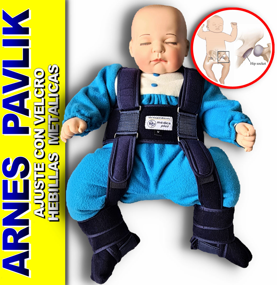 ARNES DE PAVLIK PARA LUXACION CONGENITA DE CADERA