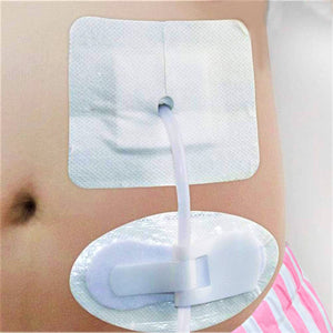 FIJADOR ADHESIVO PARA CATETER O SONDA - 3 PIEZAS - SUJETADOR AJUSTE CON VELCRO